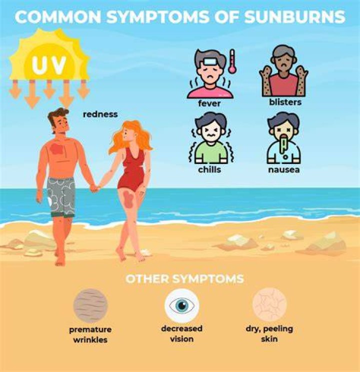 Horrific photos of teen’s severe sunburn serves as warning that sunscreen is not enough